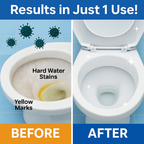 GermMukt™ All in 1 Toilet Cleaning Spray | Buy 1 Get 2 Free!